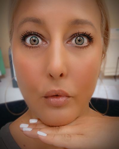 Customer photo review of [US Warehouse] [buy 2 get 2 free] Dreamlike Blue Prescription Contact Lenses