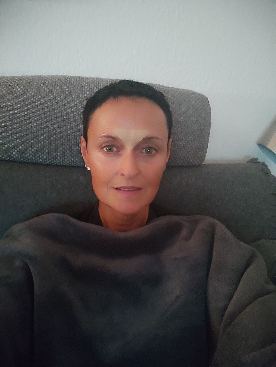 Customer photo review of Gesicht Patches (beige) mit Hyaluron