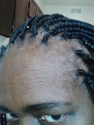 Customer photo review of [Step 6] Hair Boost: Nae Nae's Flagship Product