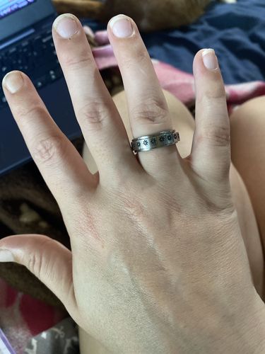 Customer photo review of Vespani Daisy Anxiety Ring