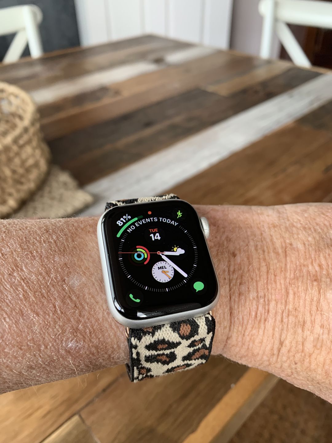 Customer photo review of Straton Stretchy Nylon Band (8 Colours)