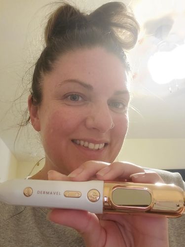 Customer photo review of Dermavel - Solo Kit