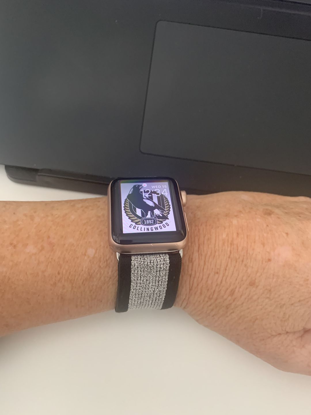 Customer photo review of Straton Stretchy Nylon Band (8 Colours)