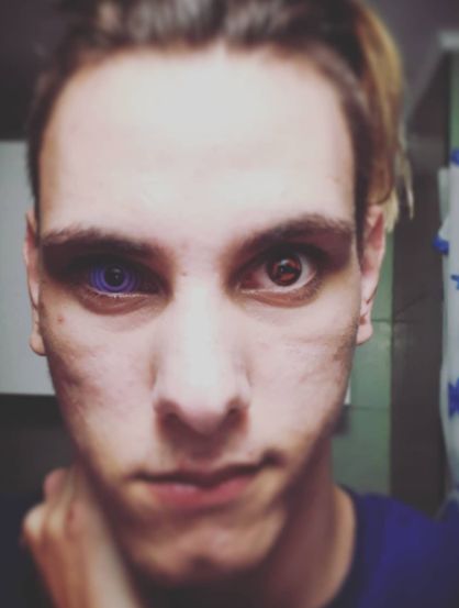 Customer photo review of Rinnegan Naruto Sclera Lenses