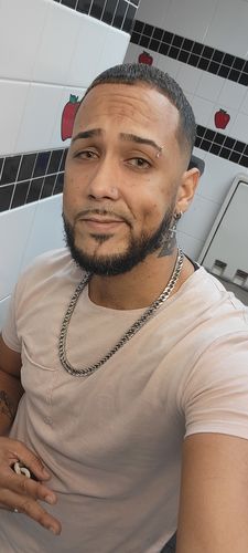 Customer photo review of Cherry Ocean Prescription Contact Lenses