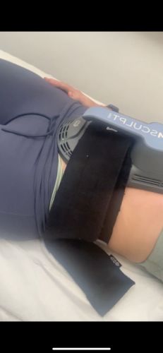 Customer photo review of AbFix: Coolsculpting
