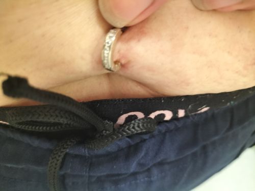 Customer photo review of TummyToys® Classic Silver CZ Sleeper Belly Ring