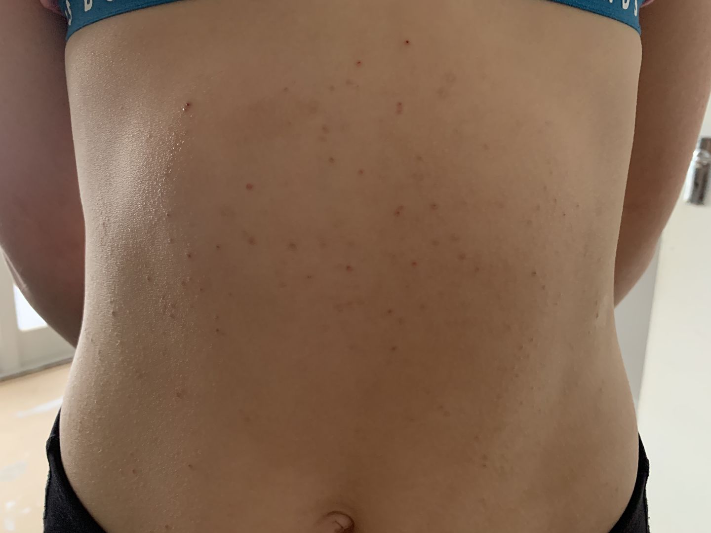 Customer photo review of Eczema Saviour