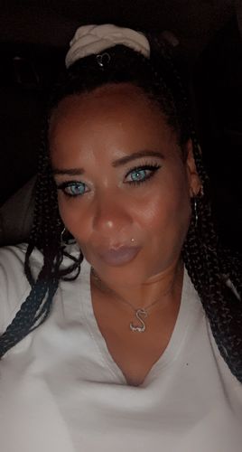 Customer photo review of Neon Blue Contact Lenses