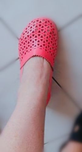 Customer photo review of Sandales Orthopédique Femmes pour Oignons