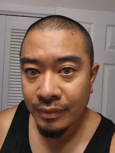 Customer photo review of Neala Green Contact Lenses(12 months wear)
