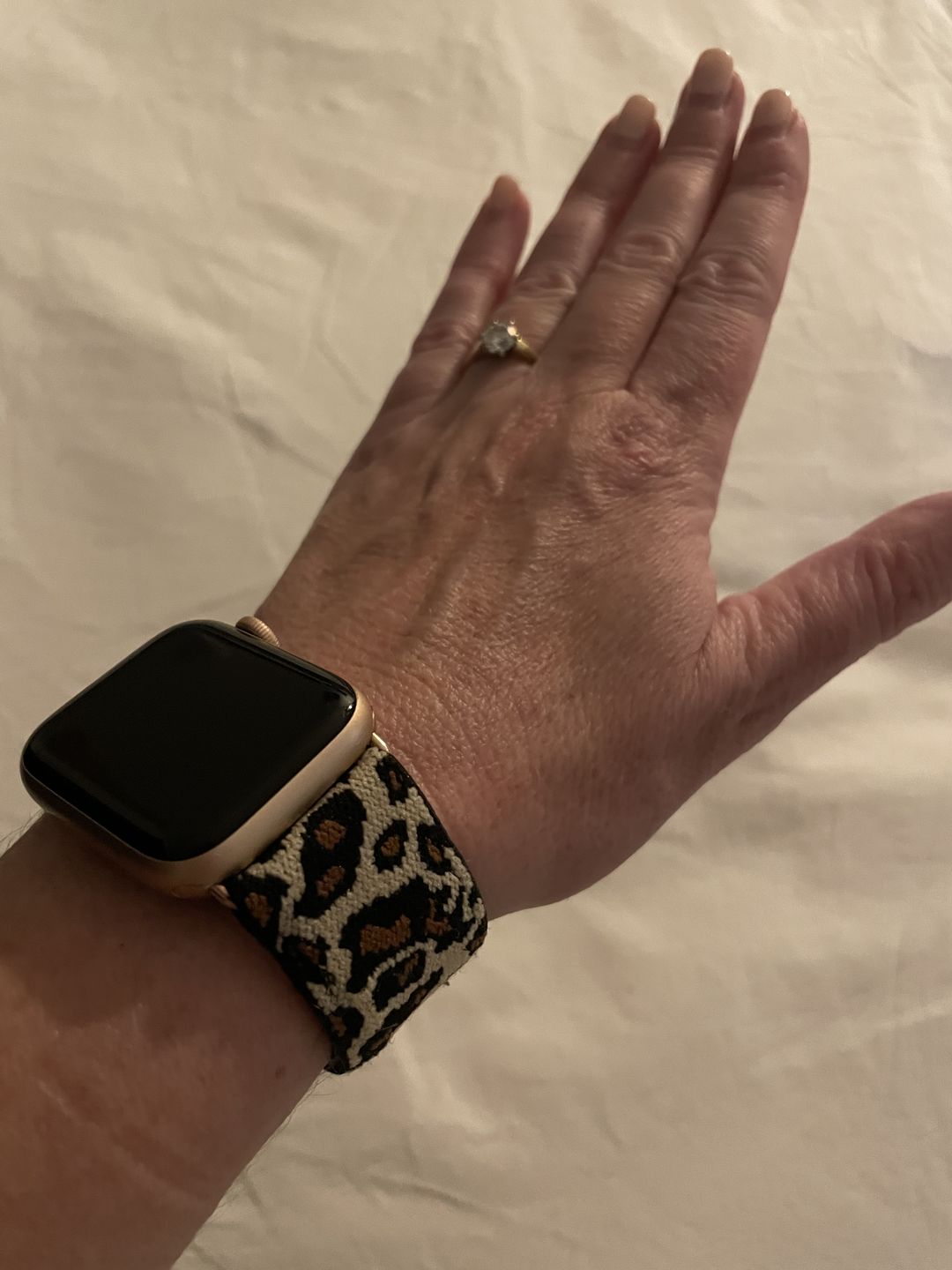 Customer photo review of Straton Stretchy Nylon Band (8 Colours)