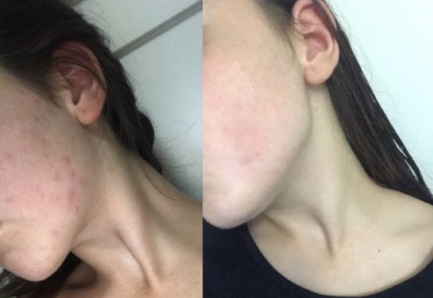 Customer photo review of Sleek Skin Serum 30ml
