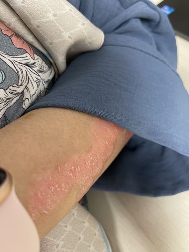 Customer photo review of Soothing Spray