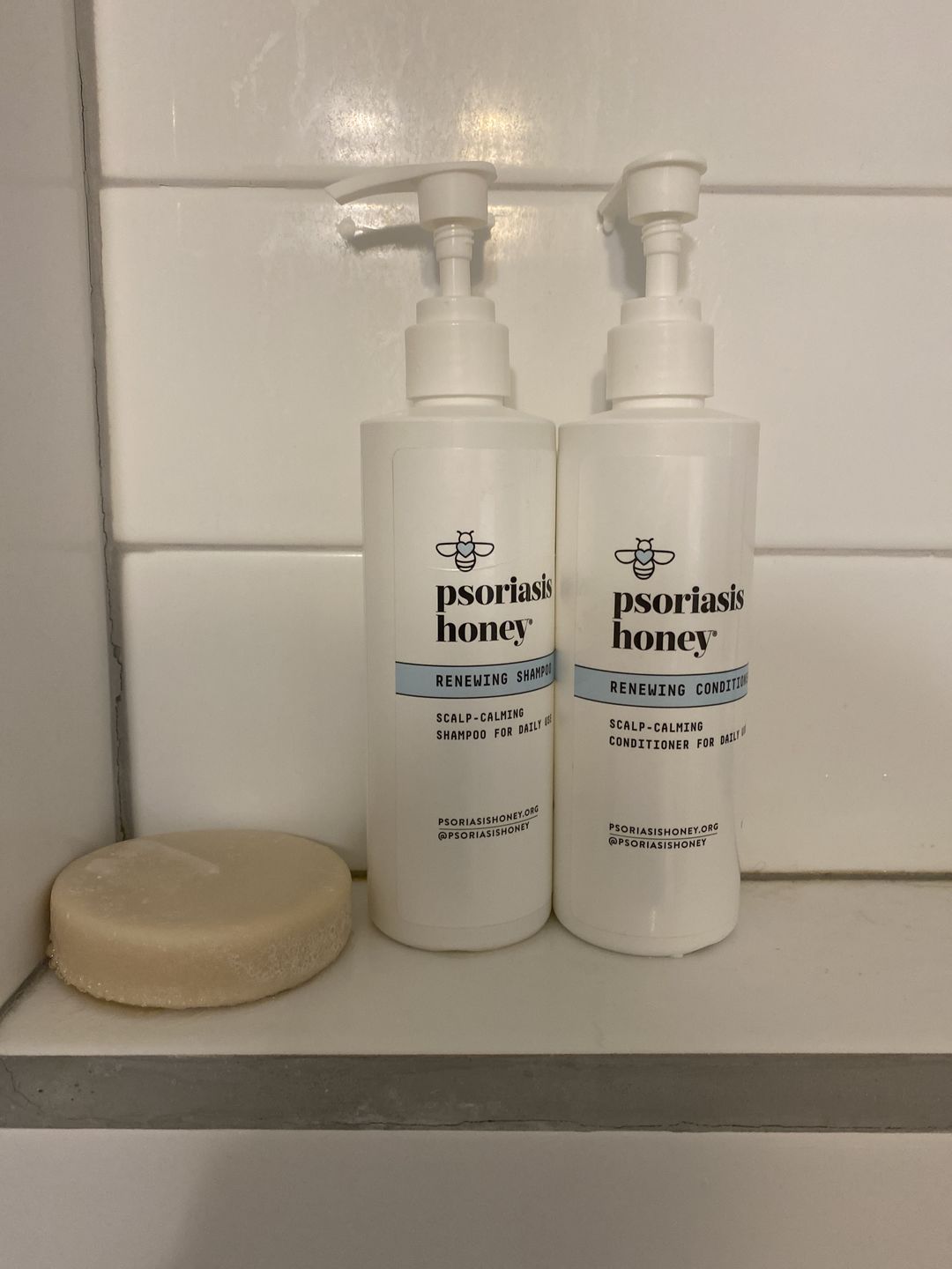Customer photo review of Psoriasis Honey Scalp Nourishing Kit