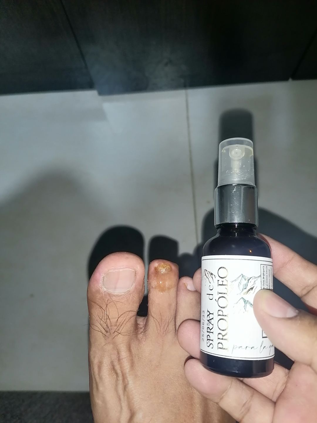 Customer photo review of Kit Defensa