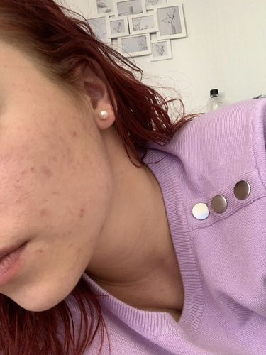 Customer photo review of [W]ASH AWAY - Purifying Gel Cleanser