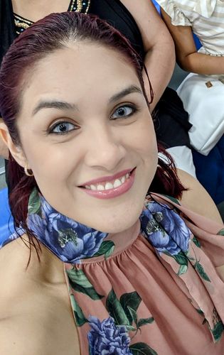 Customer photo review of Elite Snow Flake Contact Lenses