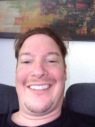 Customer photo review of Tooth-Veneer