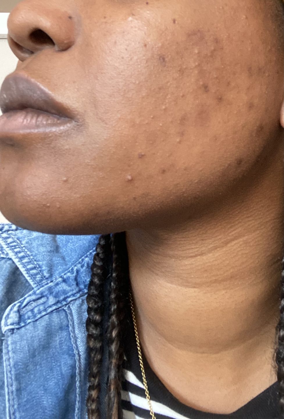 Customer photo review of HYPER G[L]O - Renewing Night Serum