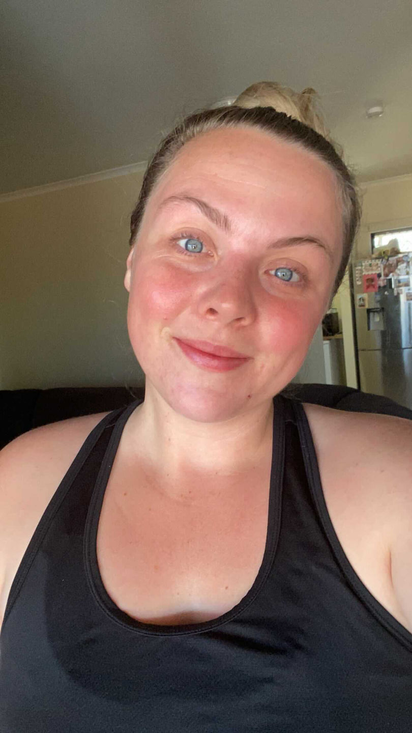 Customer photo review of I AM RADIANT FACE OIL
