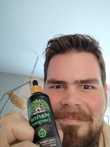 Customer photo review of Omega 3 Algenöl