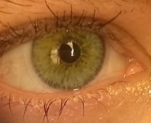 Customer photo review of Alpha Green Contact Lenses(12 months wear)