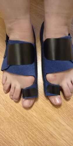 Customer photo review of Attelle orthopédique pour oignon
