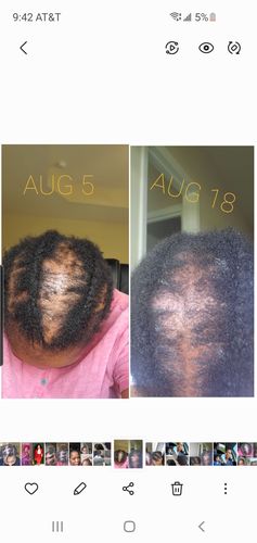 Customer photo review of Rice Water Scalp Mist (PreMade)