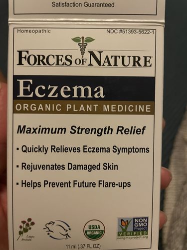 Customer photo review of Eczema Control Remedy