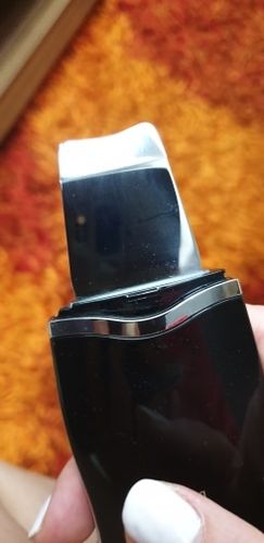 Customer photo review of Electric Ultrasonic Facial Skin Scrubber - Ionic Deep Face Cleaning