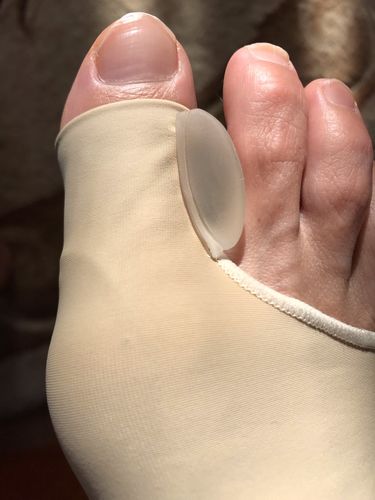 Customer photo review of Manchon orthopédique pour oignons