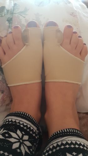 Customer photo review of Manchon orthopédique pour oignons