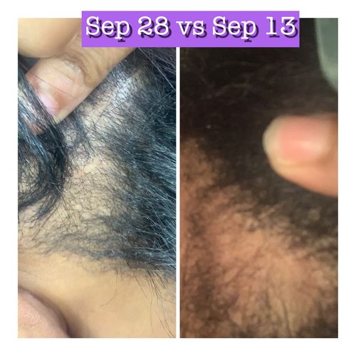 Customer photo review of Growth Sensation and Super Growth Oil Duo