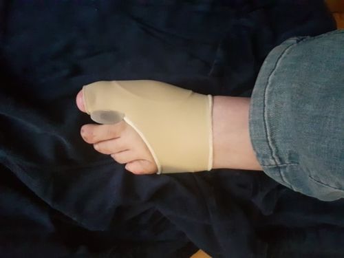 Customer photo review of Manchon orthopédique pour oignons