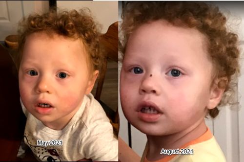 Customer photo review of Simple Spectrum Nutritional Support Supplement