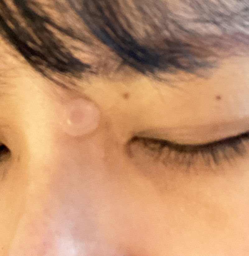 Customer photo review of Dr. wonder Wonder Patch