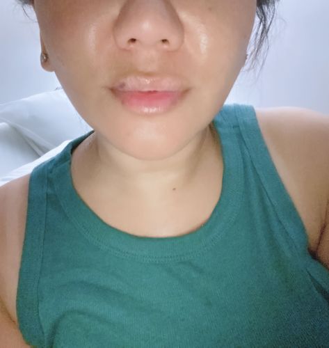 Customer photo review of LipFix: Filler