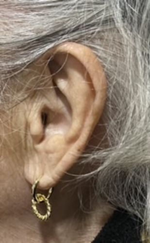 Customer photo review of QUEEN GOLD