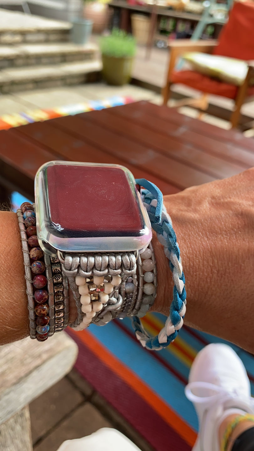 Customer photo review of Healing Turquoise Protection Apple Watch Strap