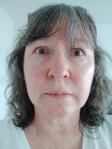Customer photo review of Repair & Renew Cream