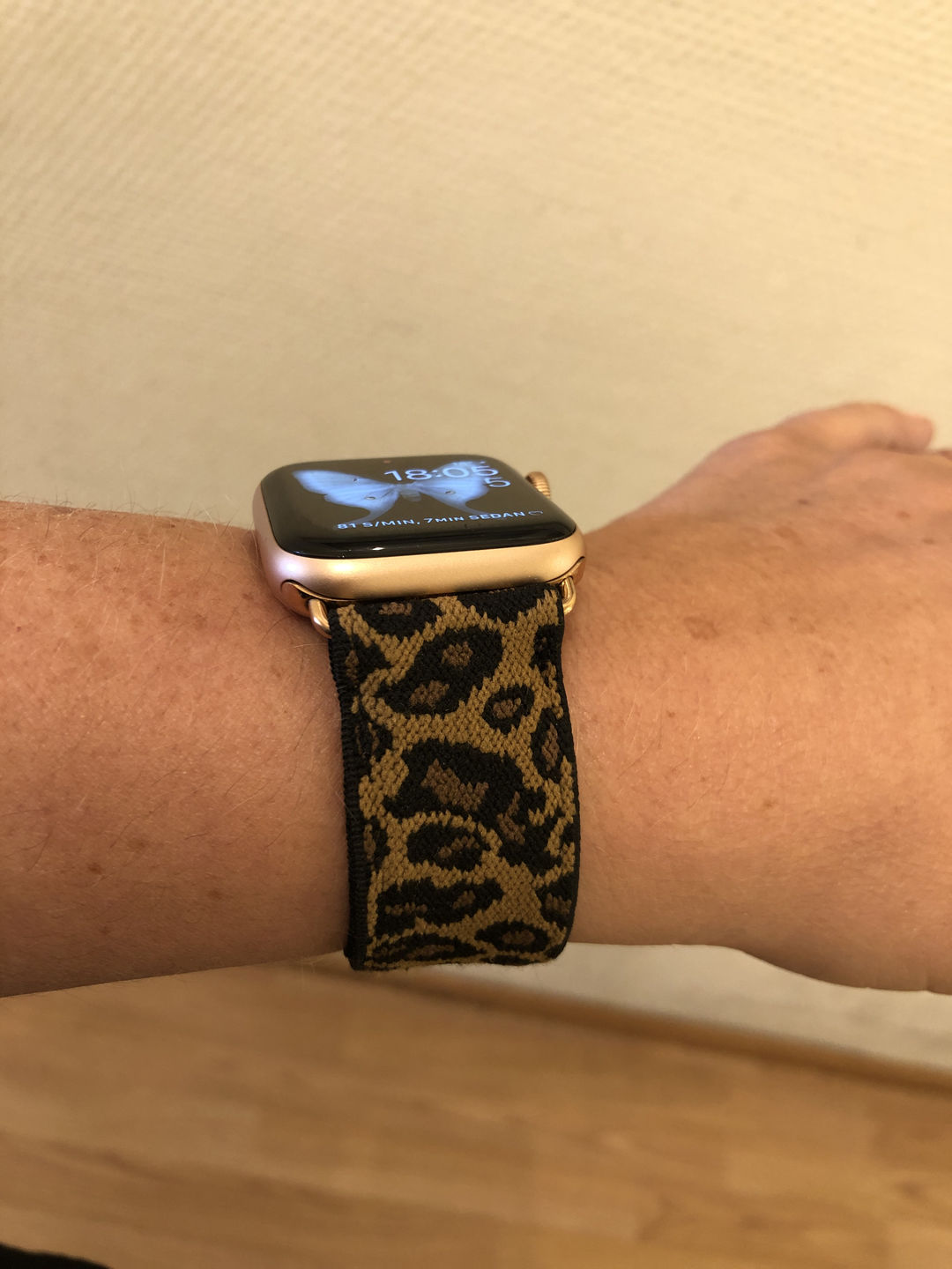 Customer photo review of Straton Stretchy Nylon Band (8 Colours)