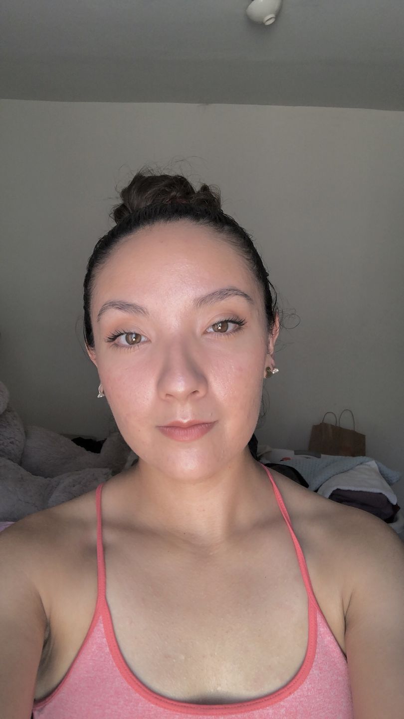 Customer photo review of Mask & Scrub / Mascarilla - Exfoliante de Tepezcohuite