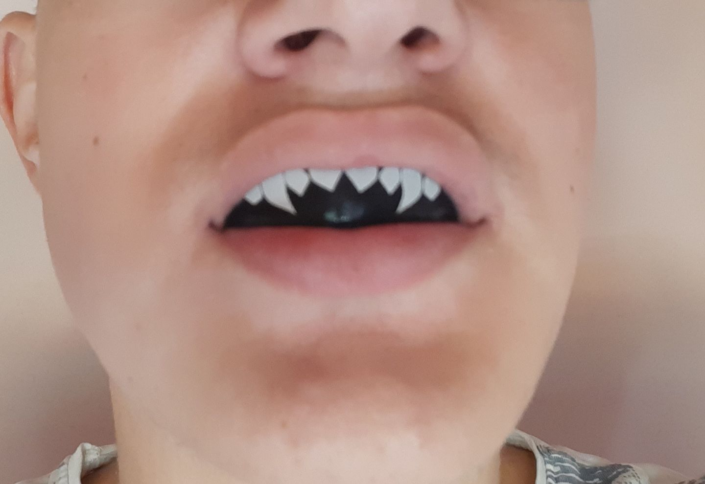 Customer photo review of Proteza Dentara Knockout GEL Vampire