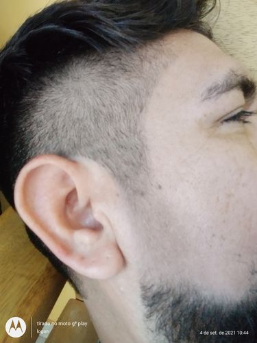 Customer photo review of Minoxidil 5% Kirkland - 6 Meses de Tratamento Contra Queda de Cabelo, Barba e Sobrancelha. (Caixa Lacrada)