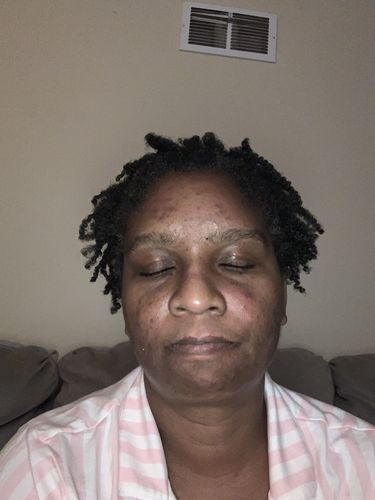 Customer photo review of Qasil Powder for Hair and Skin, Organic Qasil Powder, Qasil Powder for Face, Pack of 1, 150gm