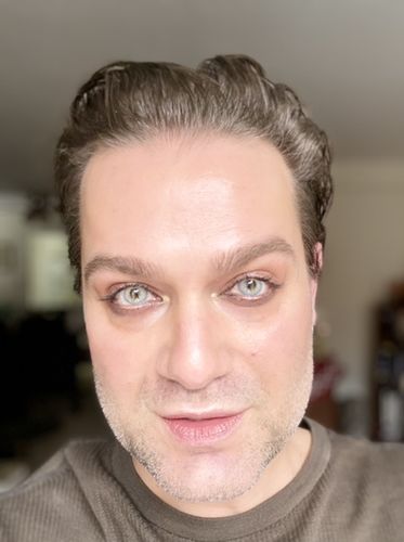 Customer photo review of La Girl Blue Contact Lenses