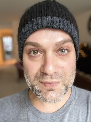 Customer photo review of [US Warehouse] Crystal Prescription Contact Lenses