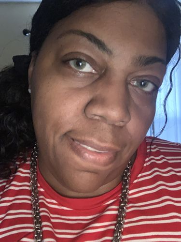 Customer photo review of Mel Prescription Contact Lenses