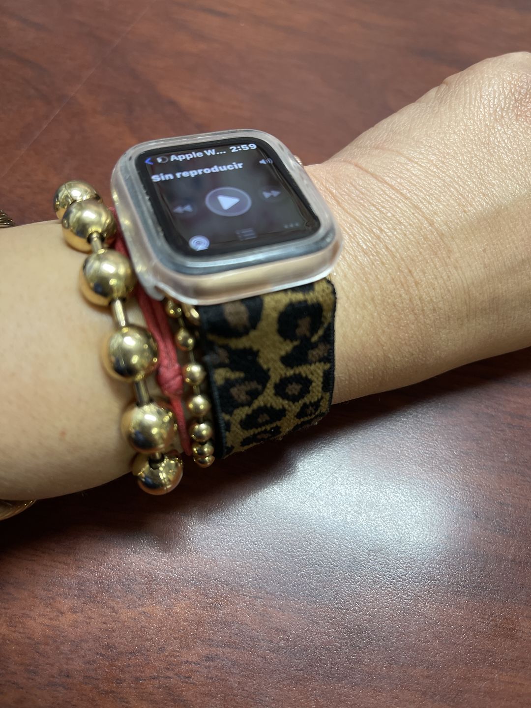 Customer photo review of Straton Stretchy Nylon Band (8 Colours)